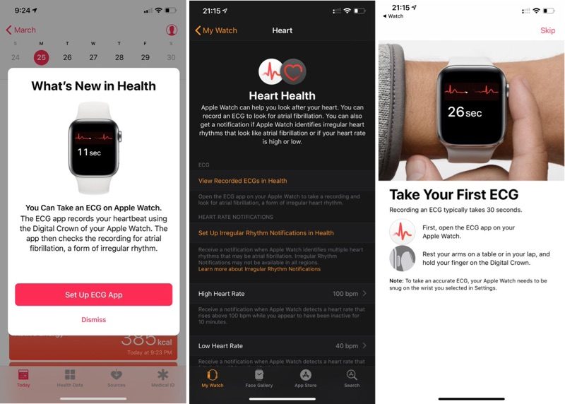 iOS 12.2 Suggests ECG App Could Soon Rollout to U.K. and Other European Countries With Release of watchOS 5.2