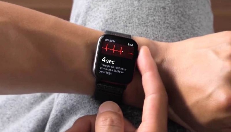 iOS 14.3 and watchOS 7.2 Include New Apple Watch ECG Algorithm Version