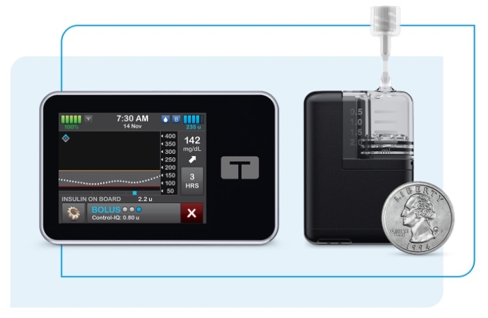 200+ People Injured After Glitchy iPhone Diabetes App Drains Insulin Pump Batteries