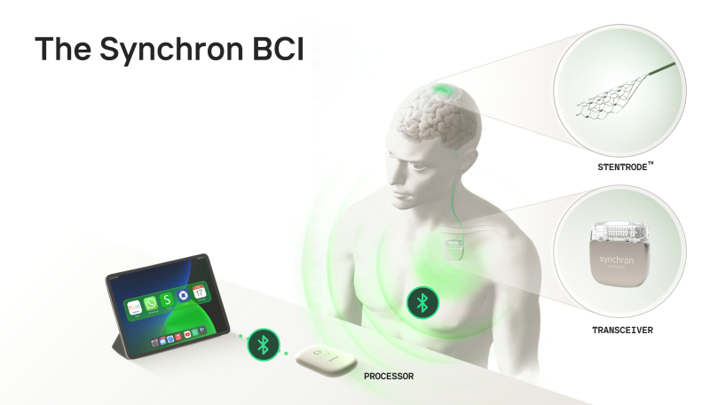 Watch As This Man Controls an iPad With His Brain