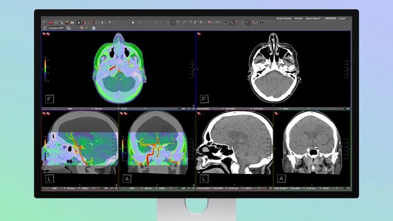 FDA Officially Clears Apple Studio Display XDR for Diagnostic Radiology Use