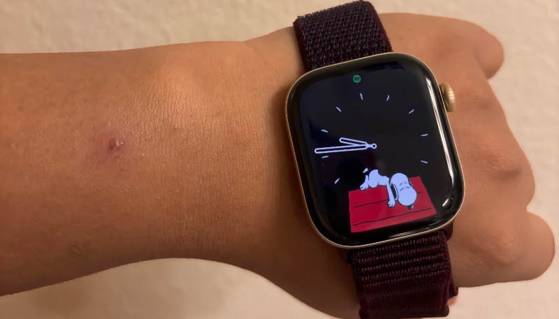 Some Owners of Apple Watch Series 12 & Apple Watch Ultra 4 Reporting Skin Irritation